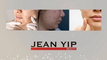 Jean-Yip-Group-38th-Anniversary-Special-Package-Promotion--350x198 10 Sep 2020 Onward: Jean Yip Group 38th Anniversary Special Package Promotion