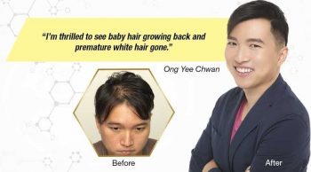 Jonsson-Protein-Healthy-Hair-Growth-1-to-1-Consultation-Promotion-350x194 22 Apr 2021 Onward: Jonsson Protein Healthy Hair Growth 1-to-1 Consultation Promotion