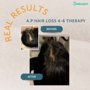 Svenson-A.P-Hair-Loss-4-6-Therapy-Promotion-350x350 22 Sep 2021 Onward: Svenson A.P Hair Loss 4-6 Therapy Promotion