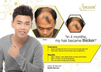 13-May-2022-Onward-Jonsson-Protein-Protein-Hair-Growth-Treatment-Promotion-350x251 13 May 2022 Onward: Jonsson Protein Protein Hair Growth Treatment Promotion