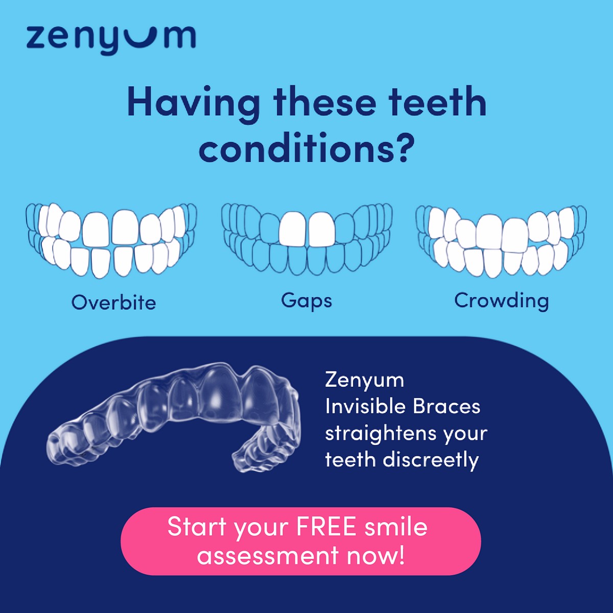 SGMY_EN_1080x1080_Having-teeth-conditions Now till 31 Aug 2022: Free Smile Assessment with Extra Discounts on Zenyum Invisible Braces