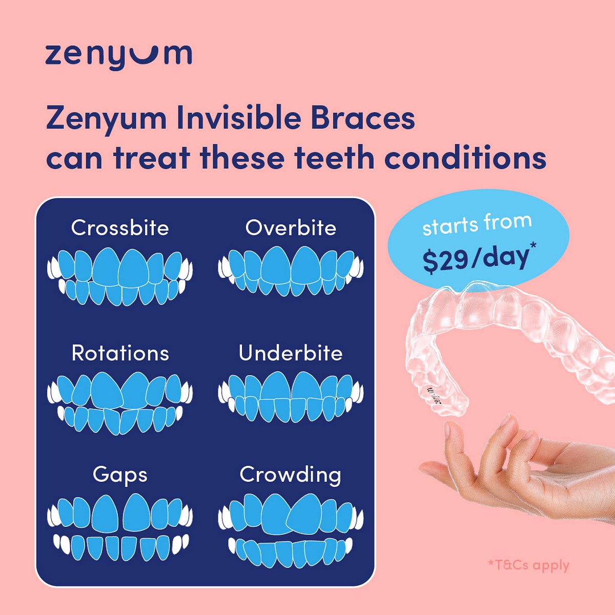Treat-teeth-conditions_SGEN_IGP_Treat-teeth-conditions Now till 31 Aug 2022: Free Smile Assessment with Extra Discounts on Zenyum Invisible Braces