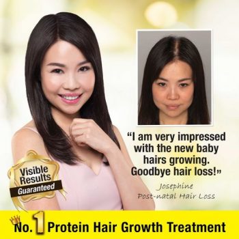17-Sep-2022-Onward-Jonsson-Protein-Hair-Growth-Treatment-Promotion-350x350 17 Sep 2022 Onward: Jonsson Protein Hair Growth Treatment Promotion